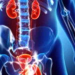 What You Should Know About Urinary Tract Infections (UTIs)
