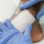 Modern Wound Care at 911 Medical Clinic_ First in Uluwatu and Pecatu