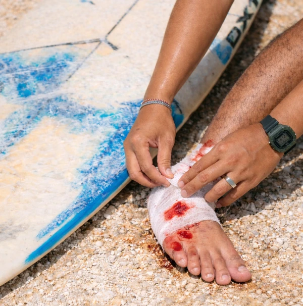 Modern Wound Care at 911 Medical Clinic_ First in Uluwatu and Pecatu (2)