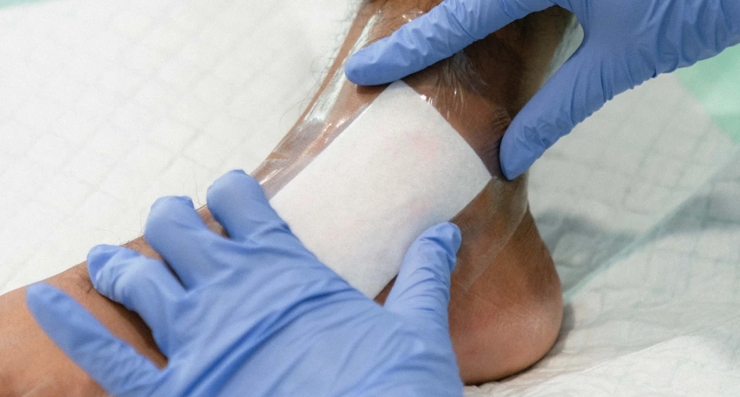 Modern Wound Care at 911 Medical Clinic_ First in Uluwatu and Pecatu
