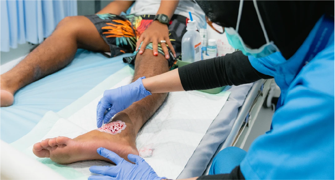 Modern Wound Care — The Smart Way to Heal Without Scars or Keloids