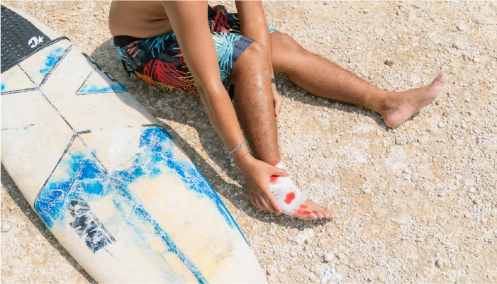 Preventing Scars and Keloids  