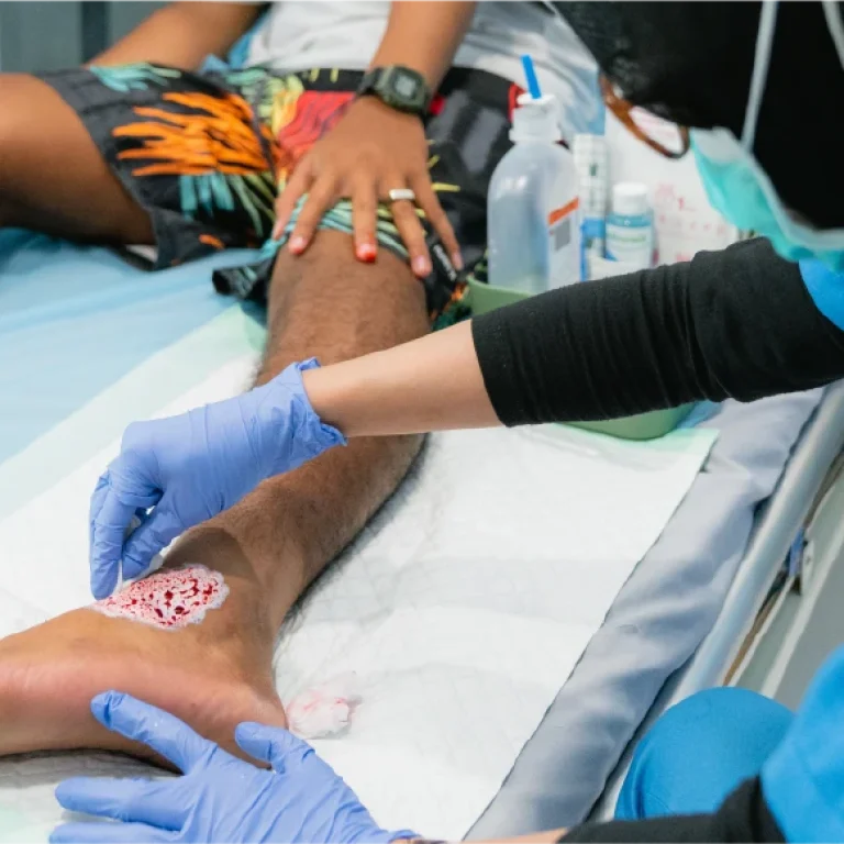 Modern Wound Care — The Smart Way to Heal Without Scars or Keloids