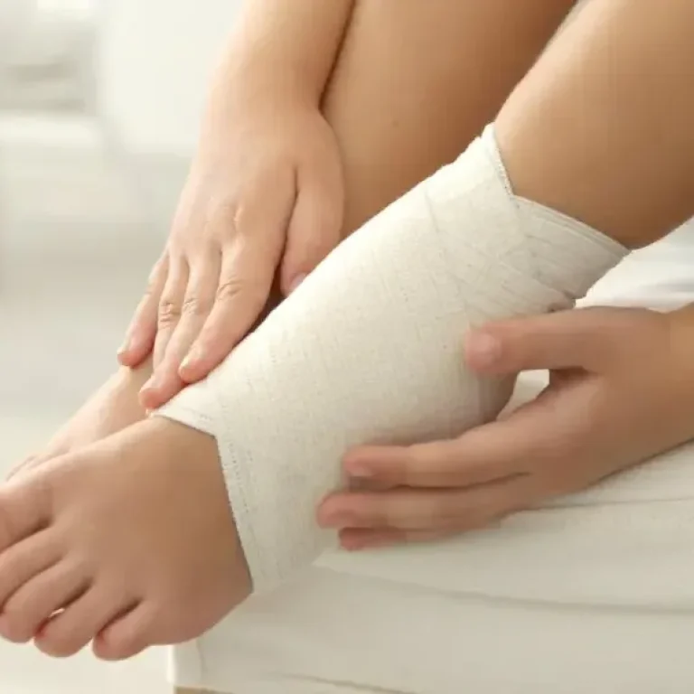 Sprain Injuries